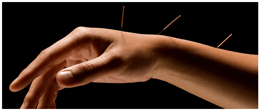 How acupuncture works